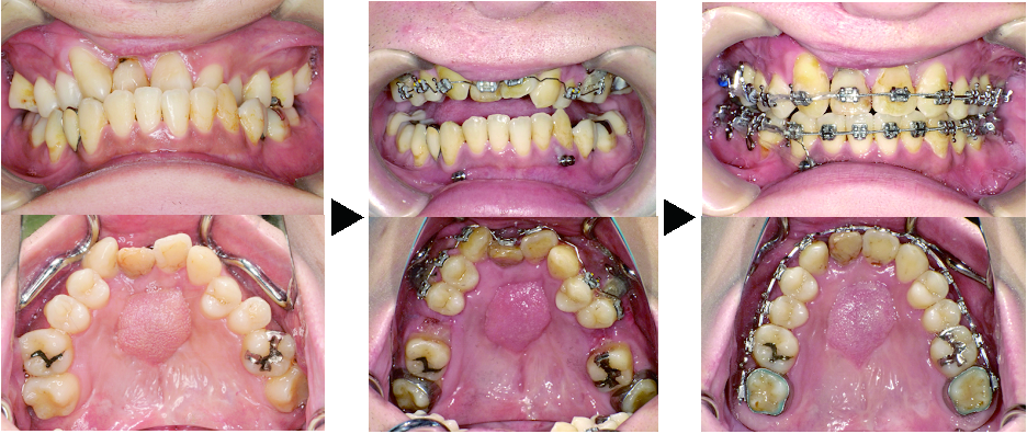 oudent-english  Orthodontics and Dentofacial Orthopedics